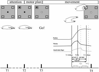 Movement-Related Activity of Human Subthalamic Neurons during a Reach-to-Grasp Task